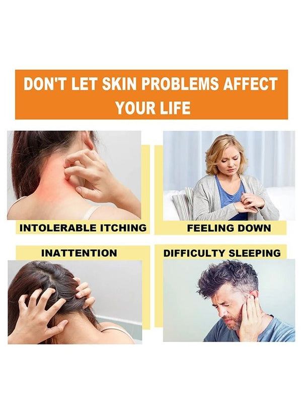 South Moon - Bee Venom Psoriasis Care Cream (Original)