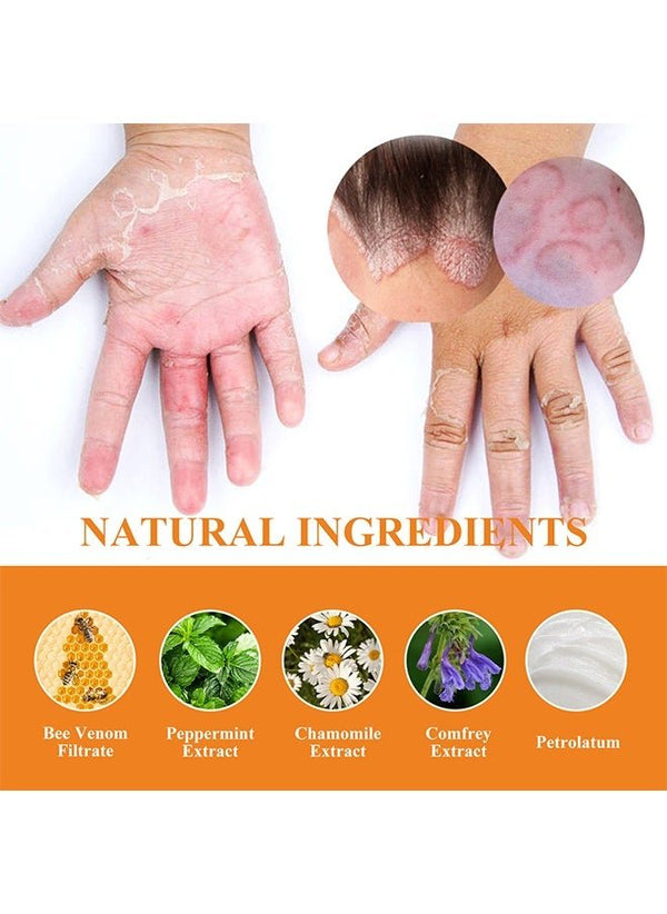 South Moon - Bee Venom Psoriasis Care Cream (Original)