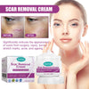 SCAR REMOVAL CREAM